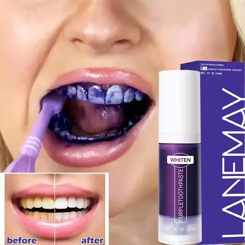 V34 Mor Diş Beyazlatma Diş Mac - Purple Toning Shampoo incelemesi ve fiyatı